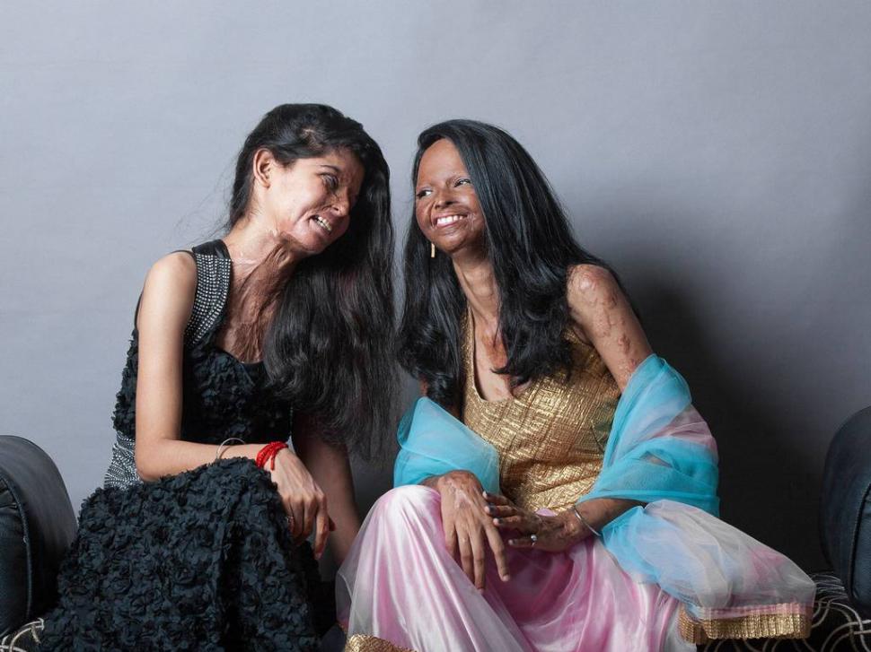 Toate aceste femei au fost desfigurate în urma atacurilor cu acid. Acum zâmbesc într-un pictorial inedit 271627