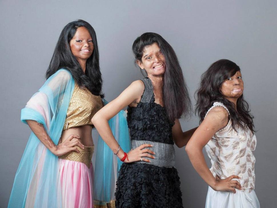 Toate aceste femei au fost desfigurate în urma atacurilor cu acid. Acum zâmbesc într-un pictorial inedit 271628