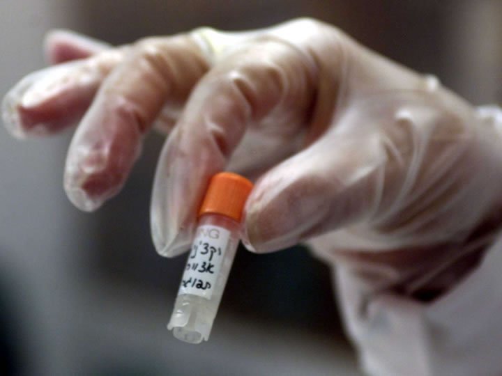 Britanicul contaminat cu Ebola este tratat cu serul experimental ZMapp