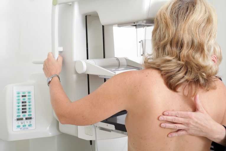 Ce au descoperit medicii despre femeile bolnav de cancer care şi-au făcut mastectomie. &quot;Şansele erau egale&quot;