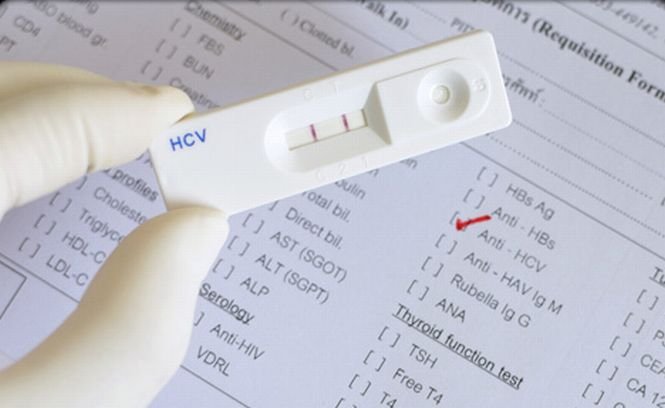Ministerul Sănătăţii a început testarea gratuită pentru depistarea hepatitei C