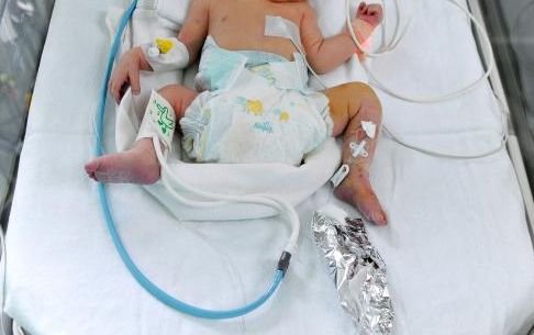 Un bebeluş din Galaţi A MURIT la câteva ore după ce a fost externat din spital
