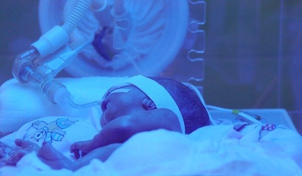 Acuzaţii grave la adresa medicilor. Doi bebeluşi au ORBIT după ce au stat la incubator, iar ochii lor NU au fost protejaţi
