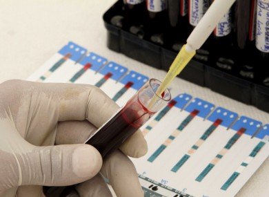 Un simplu test asupra nivelului de metal din sânge ar putea detecta cancerul de sân 