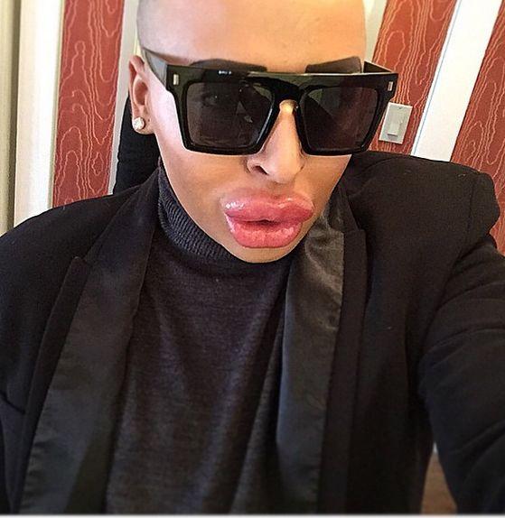 Transformarea care a şocat internetul. A plătit 100.000 de lire pentru a arăta precum Kim Kardashian. Rezultatul e DEPARTE de realitate 288080