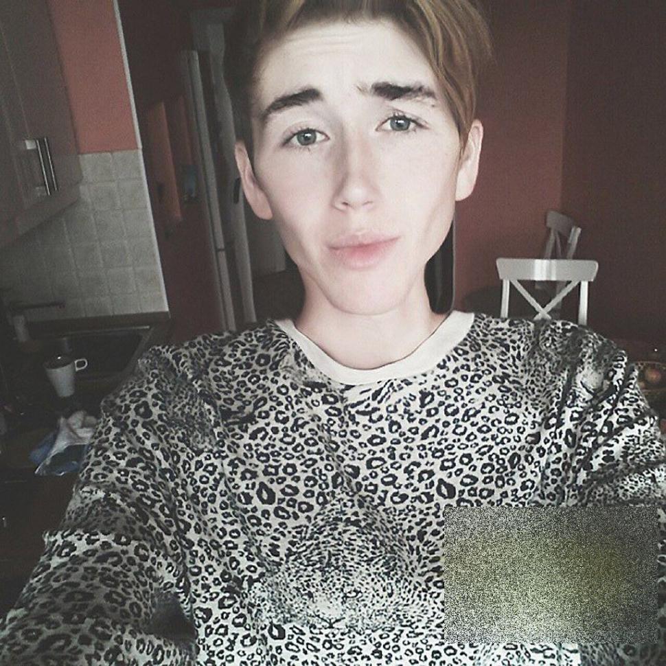 Tânărul care a şocat Rusia. Nu are strop de grăsime în corpul său: "Ajutaţi-mă! Dacă nu mănânc voi muri" 288804