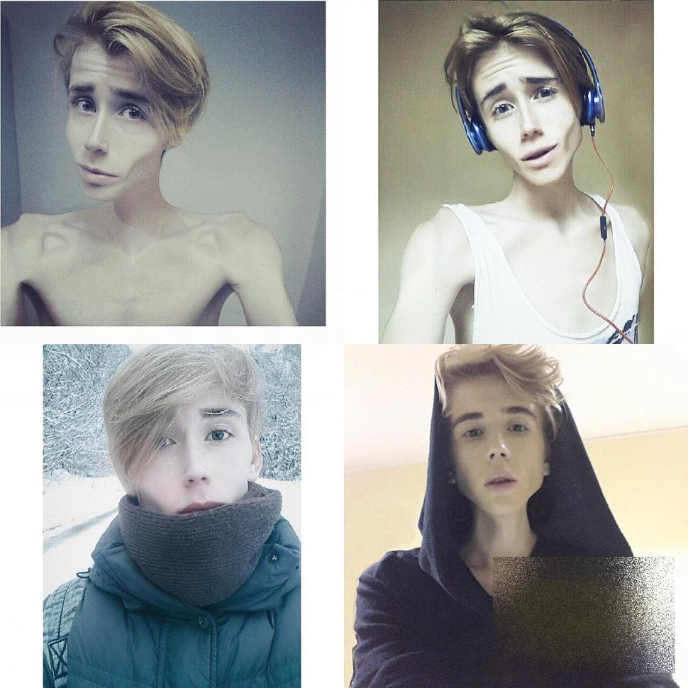 Tânărul care a şocat Rusia. Nu are strop de grăsime în corpul său: "Ajutaţi-mă! Dacă nu mănânc voi muri" 288805