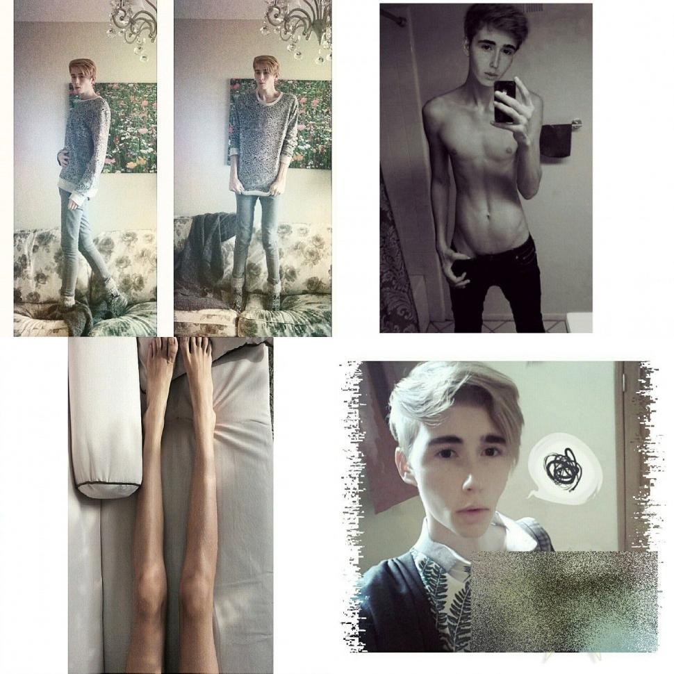 Tânărul care a şocat Rusia. Nu are strop de grăsime în corpul său: "Ajutaţi-mă! Dacă nu mănânc voi muri" 288806