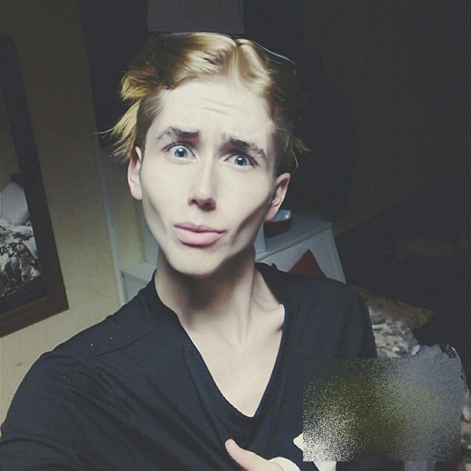 Tânărul care a şocat Rusia. Nu are strop de grăsime în corpul său: "Ajutaţi-mă! Dacă nu mănânc voi muri" 288807