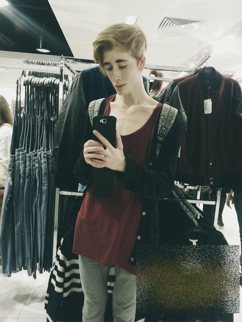 Tânărul care a şocat Rusia. Nu are strop de grăsime în corpul său: "Ajutaţi-mă! Dacă nu mănânc voi muri" 288810