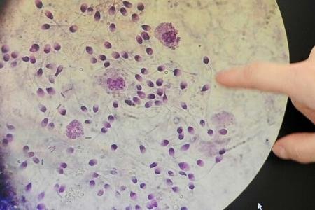 Cum răspândesc celulele canceroase în corpul uman. Răspunsul surprinzător al oamenilor de ştiinţă