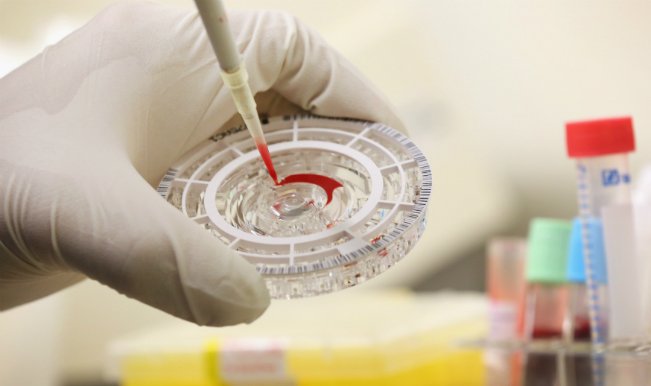 Oamenii de ştiinţă avertizează: Virusul Ebola suferă mutaţii