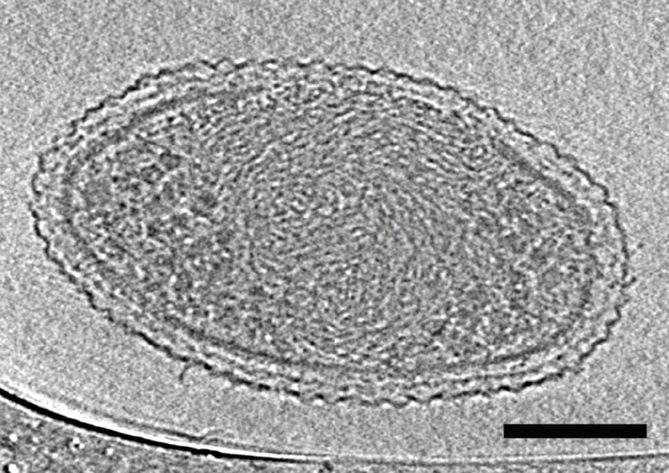 Cea mai mică formă de viaţă de pe Pământ a fost descoperită - o bacterie ultra-mică