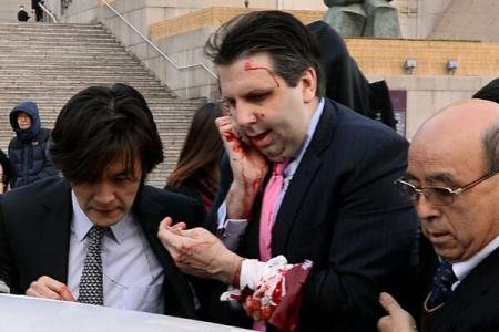 Ambasadorul american la Seul a fost rănit într-un atac 