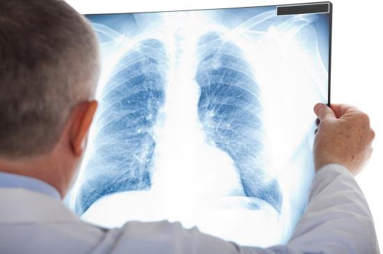 Aproape o mie de europeni contactează zilnic tuberculoza
