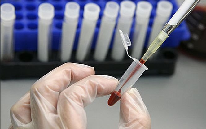 Testul rapid de sânge care va reduce administrarea inutilă de antibiotice