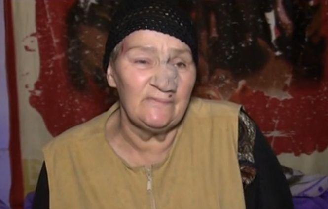 Desfigurată de rottweilerii unui vecin, o femeie din Brăila riscă să-şi piardă vederea