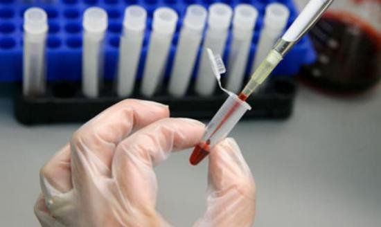 O nouă terapie împotriva HIV. Virusul poate să dispară total din sângele pacienţilor