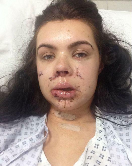 A fost DESFIGURATĂ cu sticla pentru că a oprit în mijlocul drumului! Povestea incredibilă a unei tinere dansatoare 303978