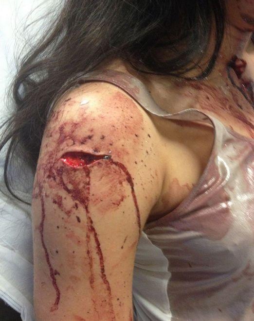 A fost DESFIGURATĂ cu sticla pentru că a oprit în mijlocul drumului! Povestea incredibilă a unei tinere dansatoare 303979