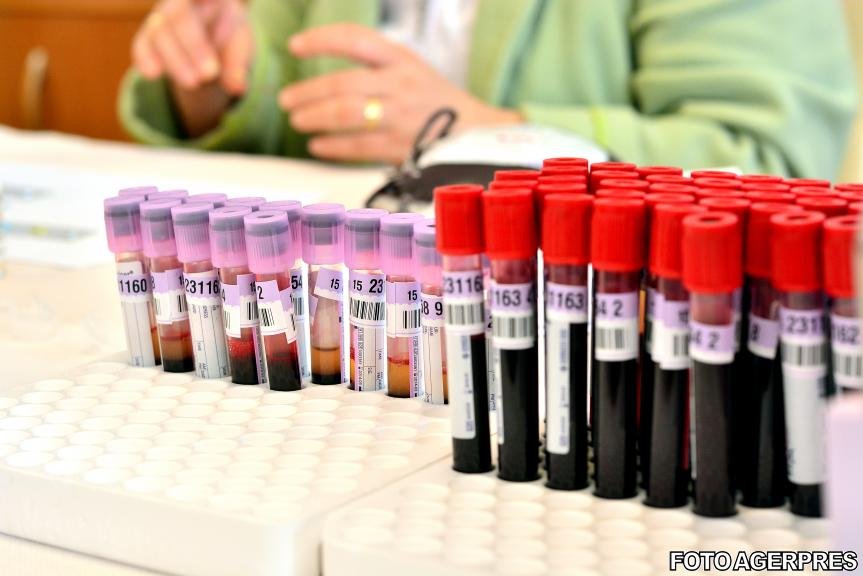 O analiză de sânge poate detecta cu o precizie de 86 % cancerul ovarian 