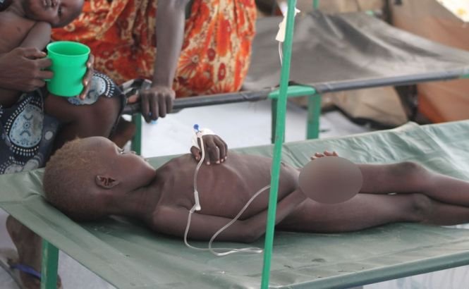 18 noi decese de holeră în Sudanul de Sud