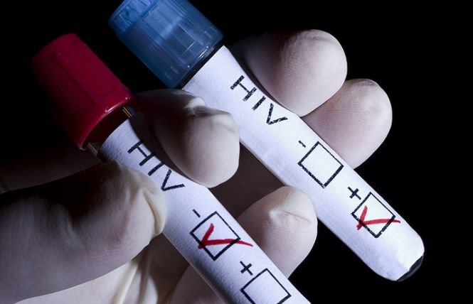 Situaţie fără precedent. 11.000 de oameni ar putea fi infectaţi cu HIV, după ce au efectuat controale stomatologice