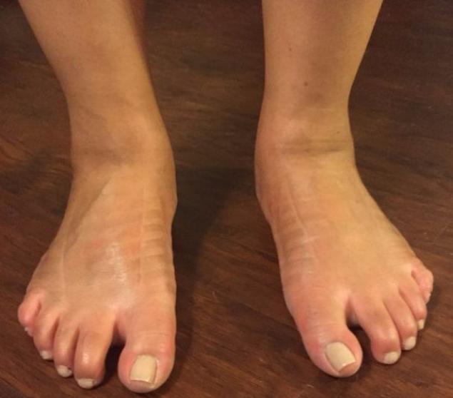 A decis să poarte tocuri timp de o săptămâna! Cum îi arată picioarele după 7 zile 318038