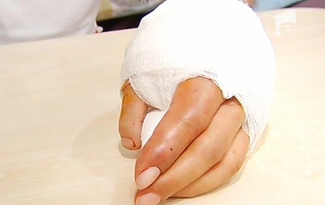 Degetul de la picior i-a completat mâna