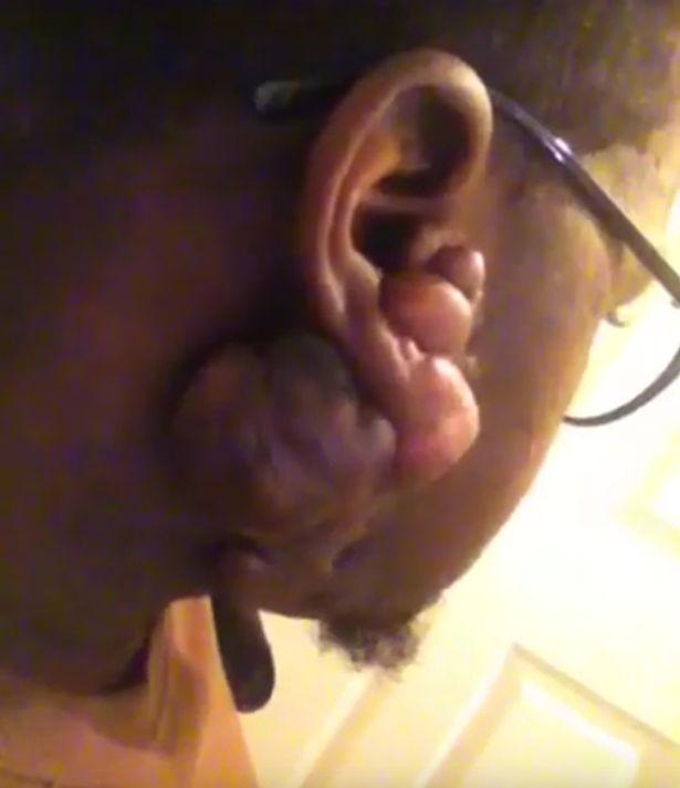 Și-a făcut găuri în urechi, iar acum îi este rușine să mai iasă din casă. De ce se gândește bărbatul la sinucidere 324976