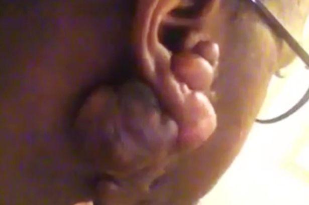 Și-a făcut găuri în urechi, iar acum îi este rușine să mai iasă din casă. De ce se gândește bărbatul la sinucidere 324977