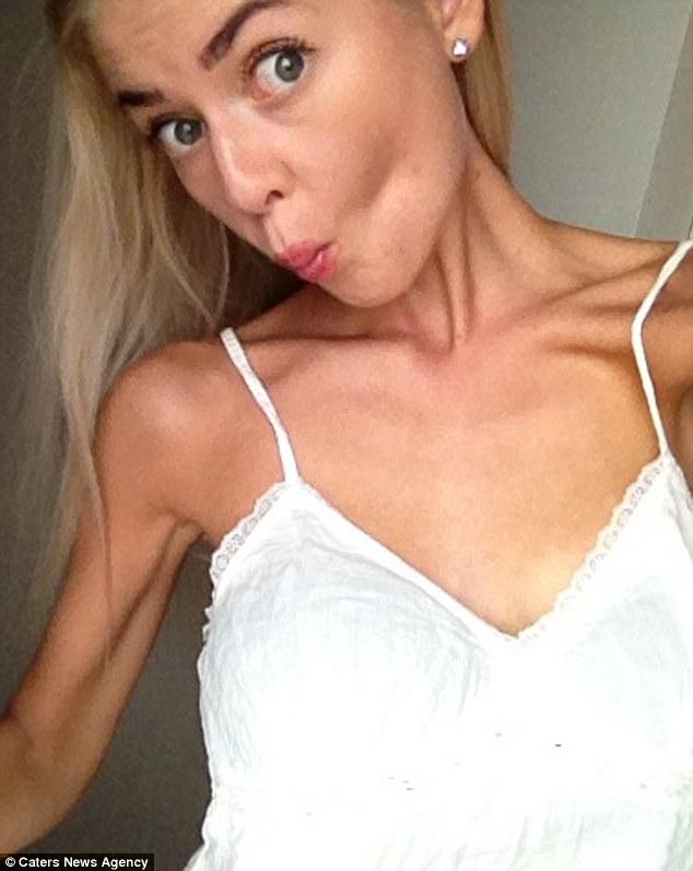 Povestea care a inspirat zeci de mii de oameni. Pozele postate de această tânără superbă sunt cu adevărat cutremurătoare: cum artăta acum trei ani 325368