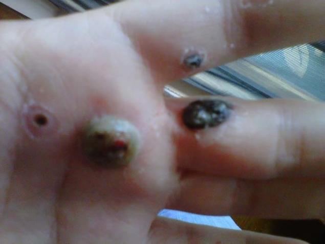 Boala ciudată de care suferă această femeie. A fost declanșată de un produs pe care îl folosesc toate femeile 326554