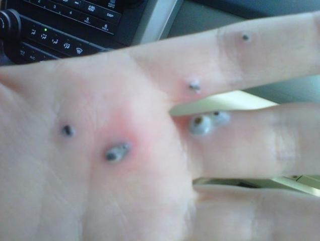 Boala ciudată de care suferă această femeie. A fost declanșată de un produs pe care îl folosesc toate femeile 326556