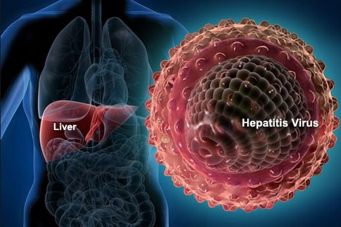 Tratament revoluţionar pentru hepatita C. Mii de români ar putea scăpa de virus