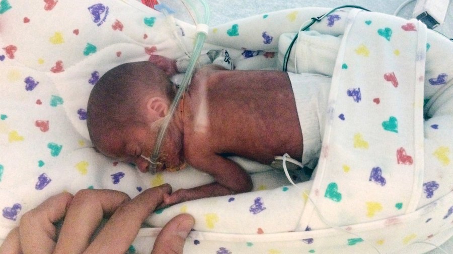 Un bebeluș-miracol. S-a născut prematur la mii de kilometri de cea mai apropiată maternitate