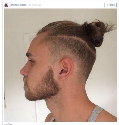 Boala gravă care poate afecta persoanele care își țin părul strâns în coadă. Imagini-avertisment publicate de medici pe internet 331122