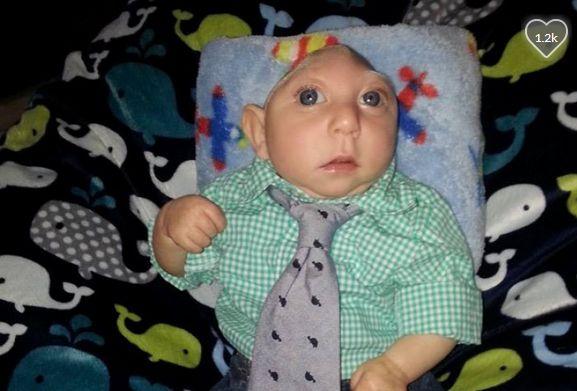 Copilul care a uimit medicii. S-a născut fără o bucată mare din scalp. Ce se întâmplă astăzi cu el 331346