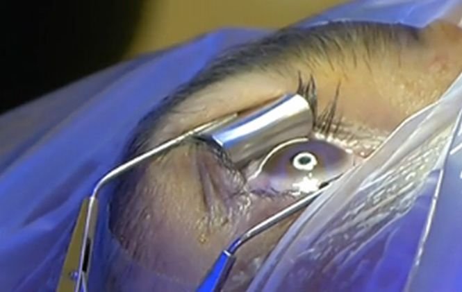 Miraculous eye surgery in Romania