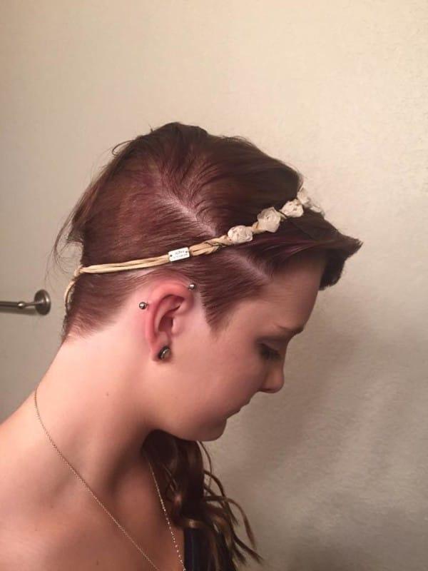 I-au turnat lipici pe cap la şcoală şi a ajuns de urgenţă la spital. Ce a făcut fata după ce medicii i-au ras părul este impresionant  335574