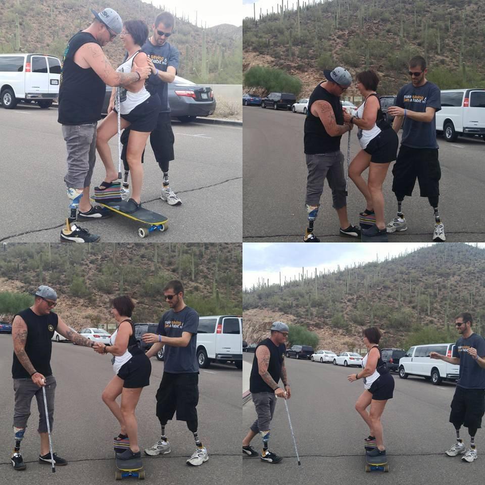 Femeia care se transformă în piatră. "Sunt ca o statuie umană". Suferă de o boală rară - FOTO 337216