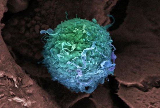 &quot;Grenadele&quot; microscopice, o nouă terapie revoluţionară contra cancerului 