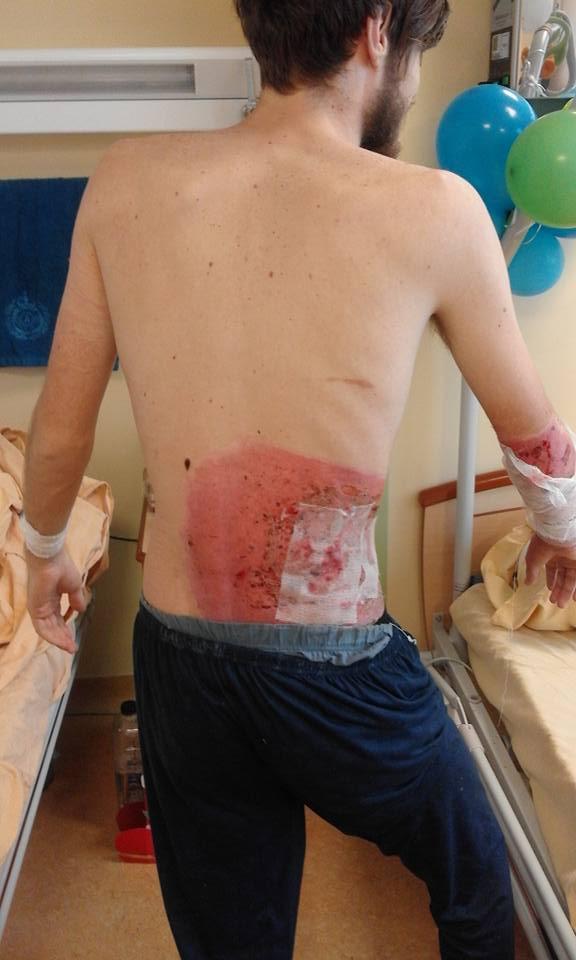 Concurentul de la X Factor, rănit în Colectiv, fotografie șocantă din spital 347594