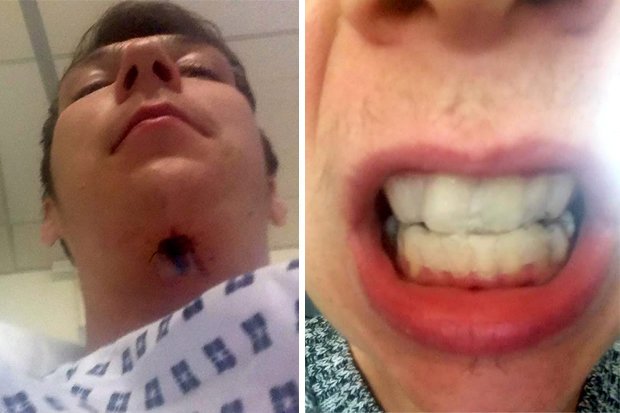 Atenție cum vă albiți dinții! Acest băiat s-a aflat la câteva secunde de moarte în urma folosirii unui remediu comun