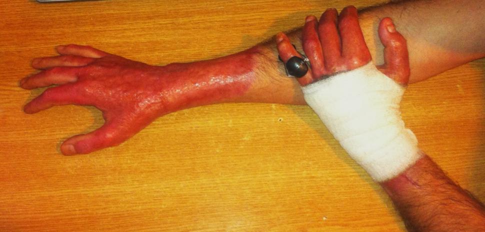  Fotografii cutremurătoare postate de un supraviețuitor din Colectiv. Dorințe pentru 2016. "Durerea este insuportabilă" 352641