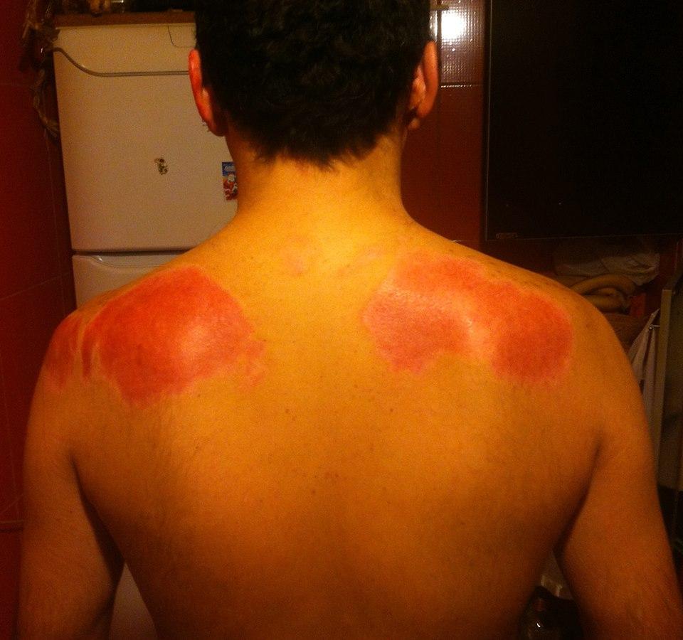  Fotografii cutremurătoare postate de un supraviețuitor din Colectiv. Dorințe pentru 2016. "Durerea este insuportabilă" 352642