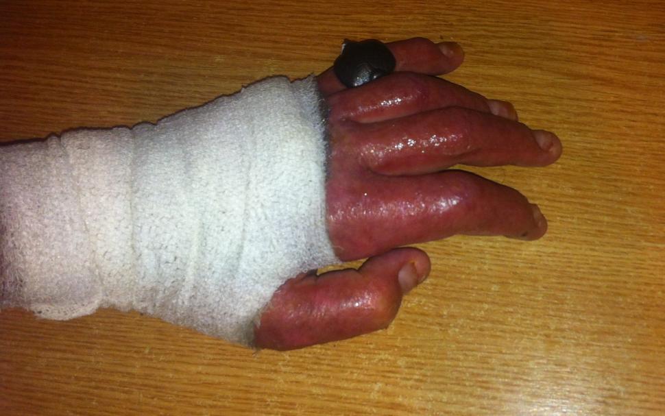  Fotografii cutremurătoare postate de un supraviețuitor din Colectiv. Dorințe pentru 2016. "Durerea este insuportabilă" 352643