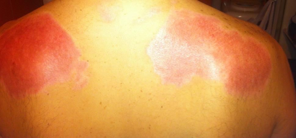  Fotografii cutremurătoare postate de un supraviețuitor din Colectiv. Dorințe pentru 2016. "Durerea este insuportabilă" 352644