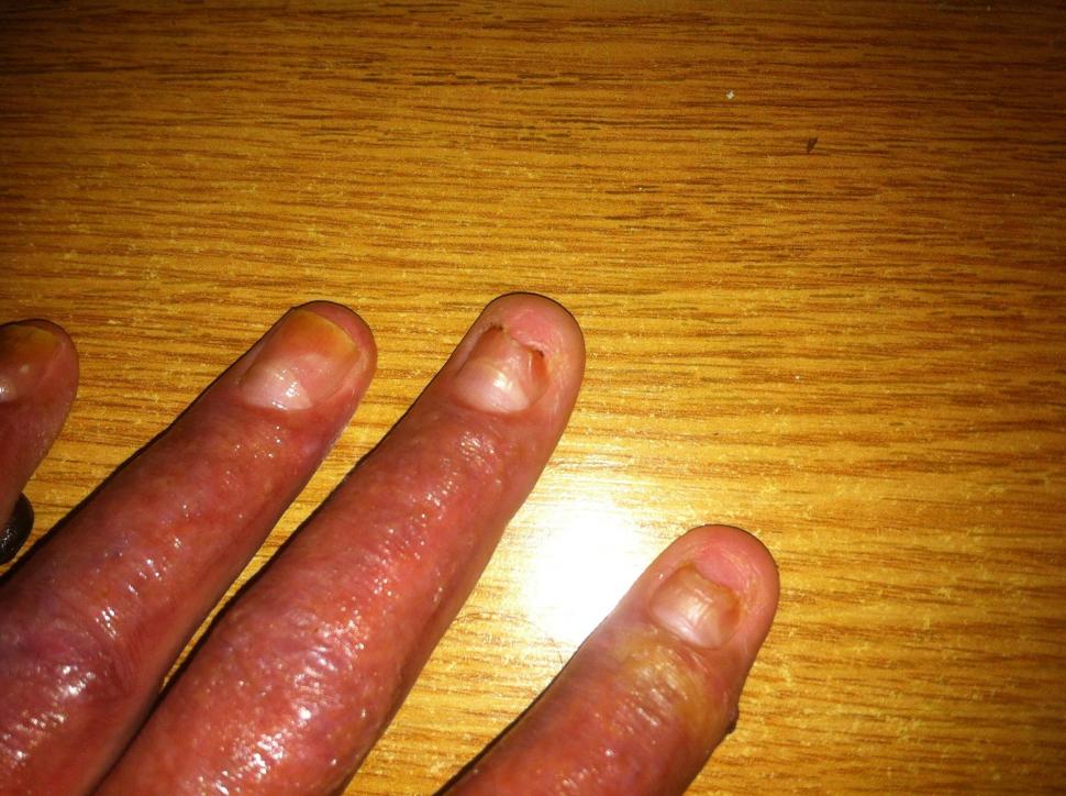  Fotografii cutremurătoare postate de un supraviețuitor din Colectiv. Dorințe pentru 2016. "Durerea este insuportabilă" 352645