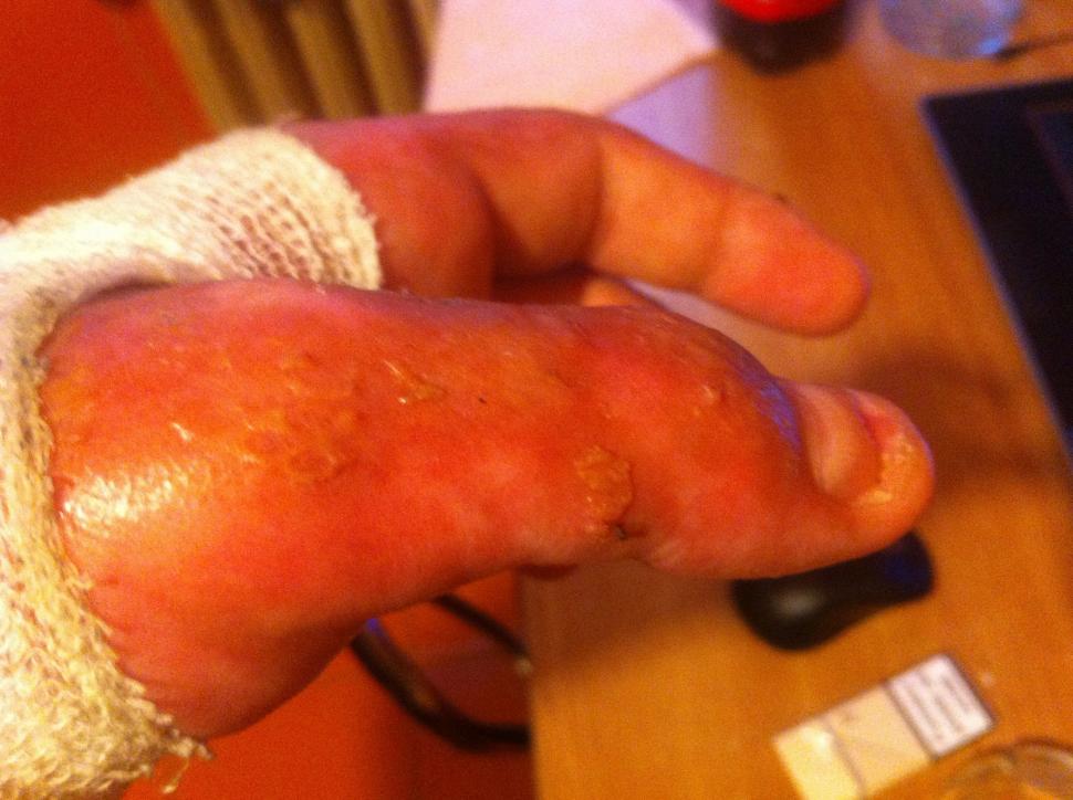  Fotografii cutremurătoare postate de un supraviețuitor din Colectiv. Dorințe pentru 2016. "Durerea este insuportabilă" 352646